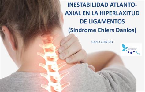 Inestabilidad Atlanto Axial Clínica Reumatológica Dr Ponce