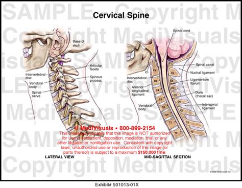 Cervical Spine Medical Exhibit Medivisuals