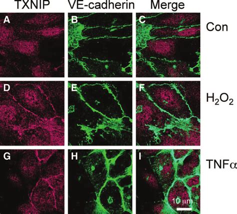 TNF And H 2 O 2 Stimulate TXNIP Plasma Membrane Translocation Assayed