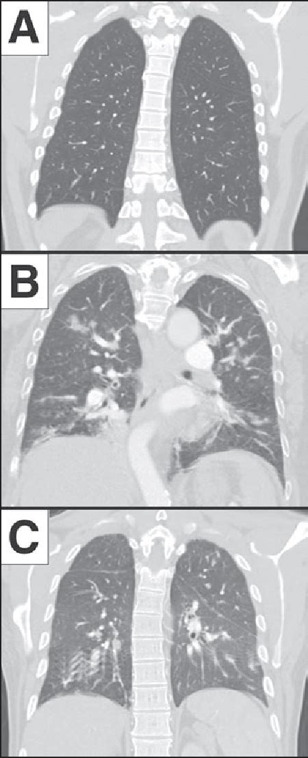 Figure 2 From Comparison Of Respiratory Motion Artifact From