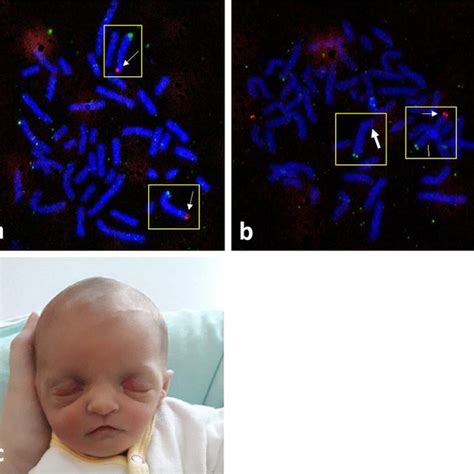 Metaphase fluorescence in situ hybridization (FISH) analysis on ... 