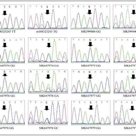 Chromatograms Show Wild Type Homozygous Alleles And Mutant Heterozygous Download Scientific