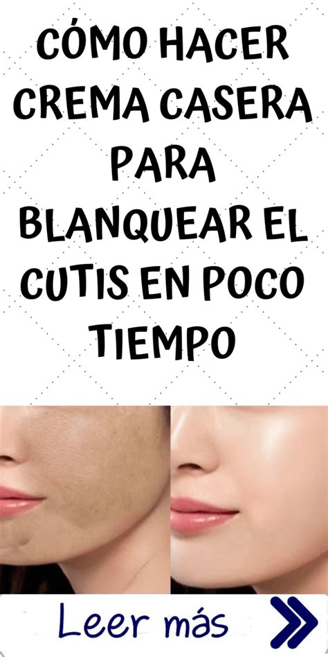 CÓMO HACER CREMA CASERA PARA BLANQUEAR EL CUTIS EN POCO TIEMPO