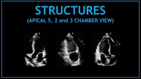 Cardiac Structures Apical And Chamber Views Echocardiography