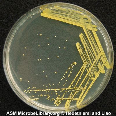 Micrococcus luteus - Citizendium