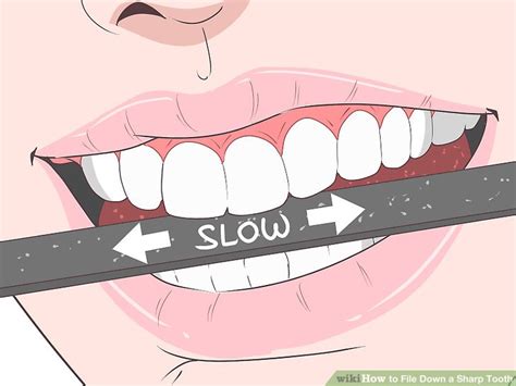 4 Ways To File Down A Sharp Tooth Wikihow