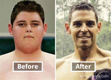 Heres How Weight Loss Can Change Your Face 40 Pics