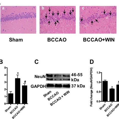 WIN55 212 2 Protects Against CCH Induced Hippocampal Degeneration And