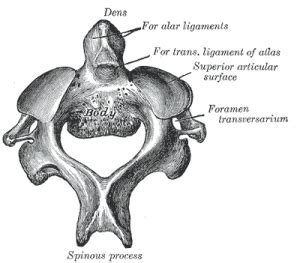 Odontoid process - Physiopedia