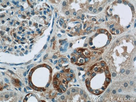 PIPPIN antibody 25013 1 AP Proteintech 武汉三鹰生物技术有限公司