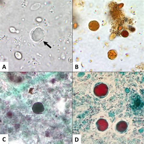 Blastocystis Spp Scheda Parassitologica Ed Approfondimenti