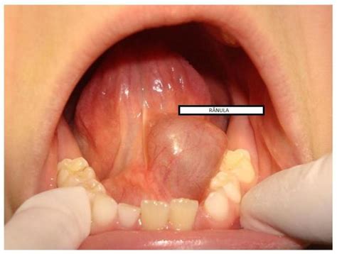 Cirurgia Pedi Trica Curitiba Dra Karimy H Mehanna R Nula