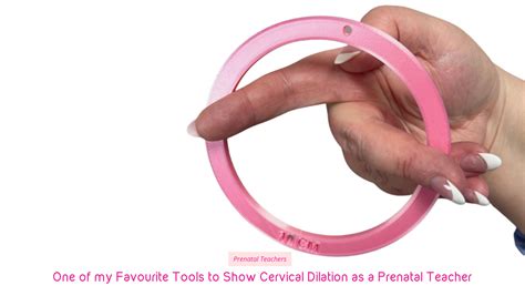 Cervical Dilation