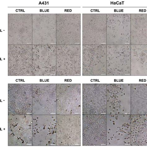 Morphology Of A And Hacat Cells Exposed To Led Cisplatinum And Led