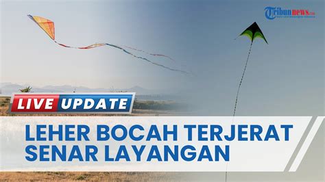 Terjerat Senar Layangan Leher Bocah Tahun Di Ciamis Jawa Barat