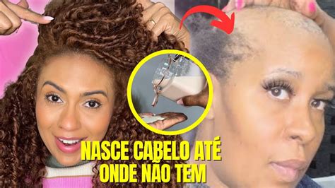 O cabelo cresce como um louco e não cai esta é a melhor ferramenta