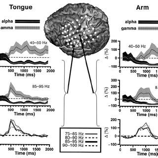 Maps Of Ecog Spectral Analysis And Cortical Stimulation Results During