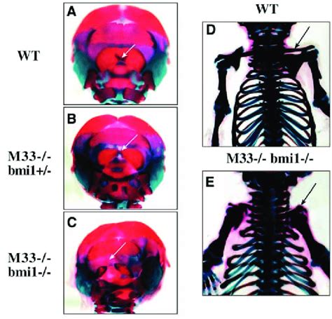 New Skeletal Defects In M33 −− Bmi1 −− Mutant Mice A In A