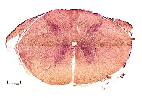 Spinal Cord Cross Section Diagram Quizlet