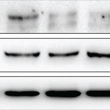 Effects Of Thalidomide On Inos Cd Arg And Tnf Protein