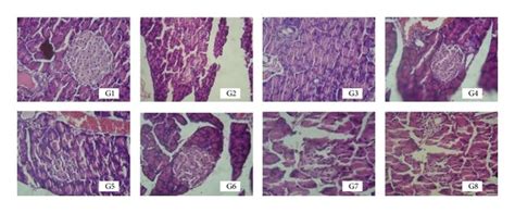 Histopathology Of Rat Pancreas 40x G1 Normal Control G2 Diabetic