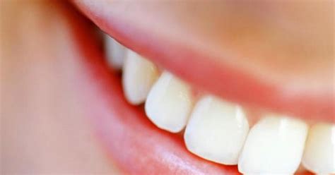 Guia De Significados De Sonhos Significado De Sonhar Dente