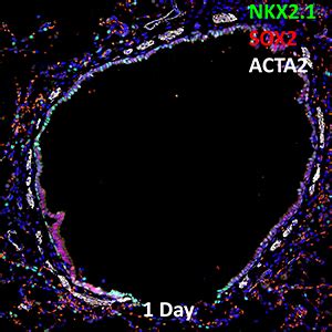 1 Day Old Human Lung NKX2 1 SOX2 And ACTA2 Confocal Imaging