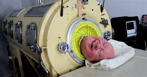 Man Who Spent 70 Years Living Inside Iron Lung Has Died Aged 78