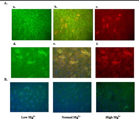 Figure 1 From Transcriptional Regulation Of The Claudin 16 Gene By Mg2