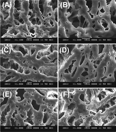 Calcium Phosphate Bioceramics With Polyvinyl Alcohol Hydrogels For