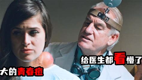 女人脖子长个巨大囊肿，最后竟然爬出来一只怪物 腾讯视频