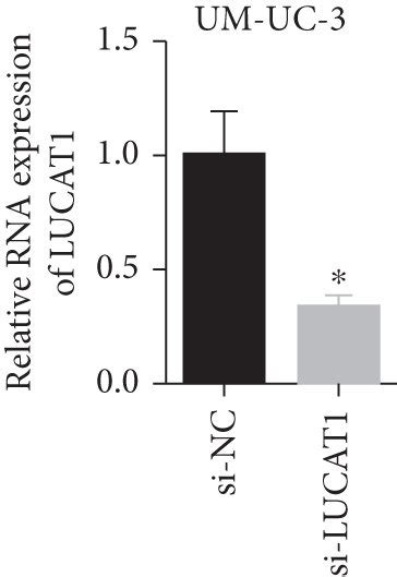 Lucat1 Downregulation Repressed Cell Proliferation Migration And