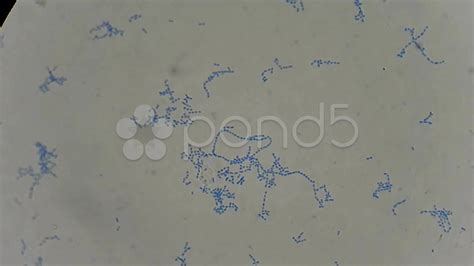 Mamut persecuţie Jurământ streptococcus pyogenes under microscope ...