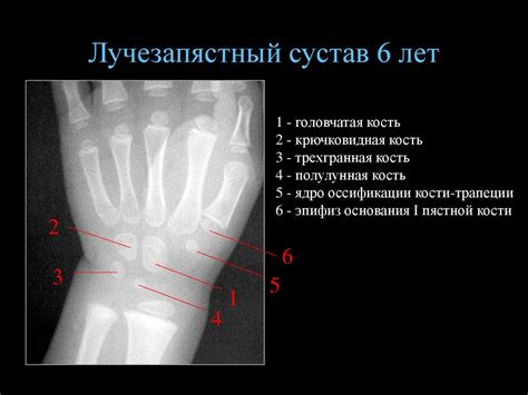 Снимок локтевого сустава - презентация онлайн