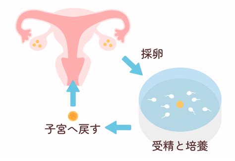 体外受精・胚移植｜ソフィア祐子レディースクリニック｜川口 不妊治療