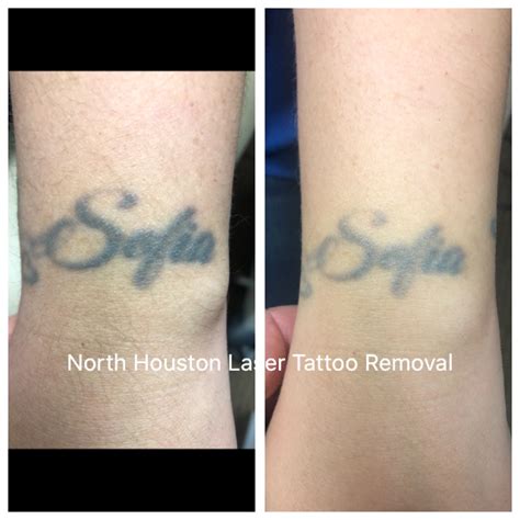 How long will it take before I see my tattoo fade? | North Houston ...