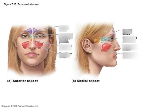 Paranasal Sinuses Fig 9 11 Diagram Quizlet