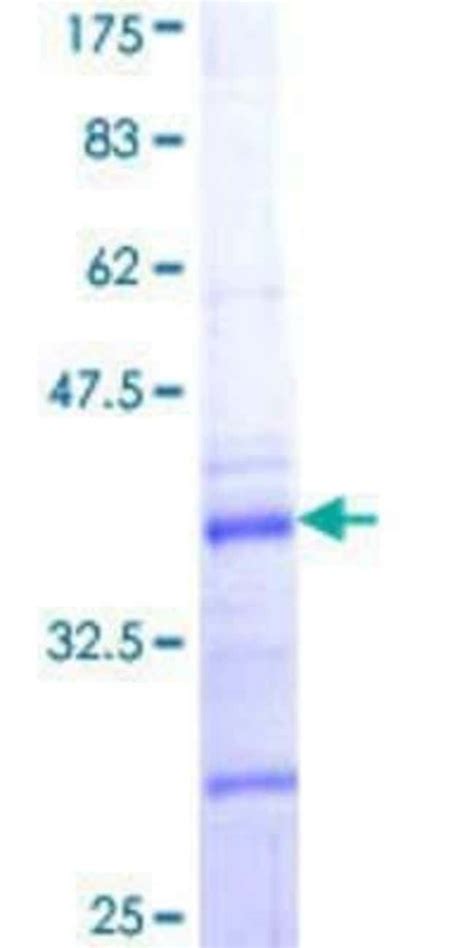 Novus Biologicals Recombinant Human Collagen V Alpha 2 GST N Term