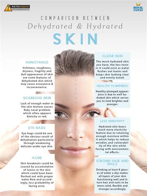 Hydrated And Dehydrated Skin Cosmetic Skin Care Dehydrated Skin