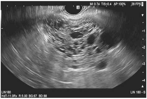 Diagnostics Free Full Text Role Of Endoscopic Ultrasound In The