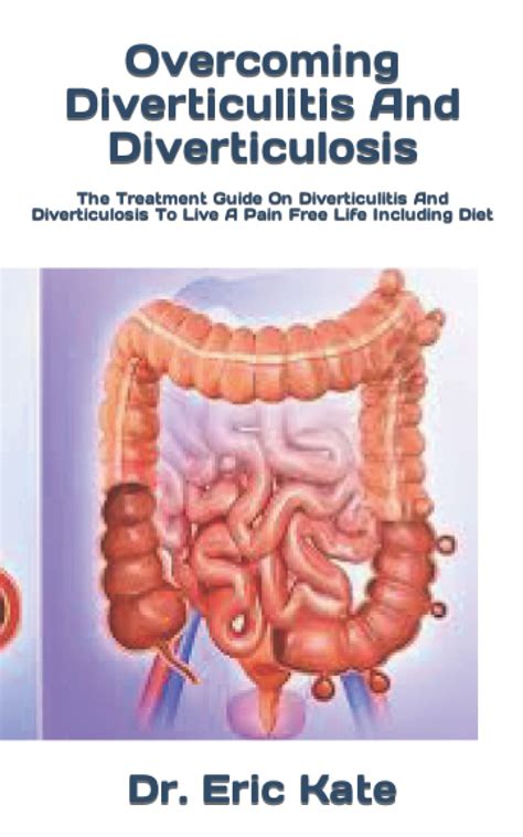 Buy Overcoming Diverticulitis And Diverticulosis: The Guide On ...