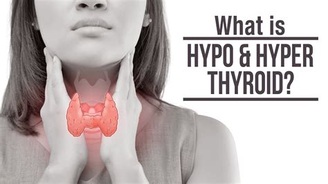 What Is Hypo And Hyper Thyroid Symptoms Of Hypothyroidism