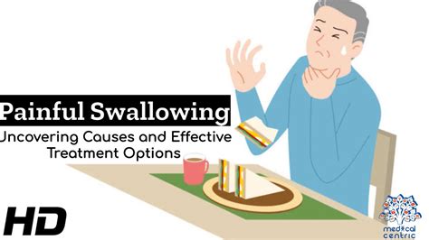 Swallowing Problems Unveiled Causes And Remedies Youtube