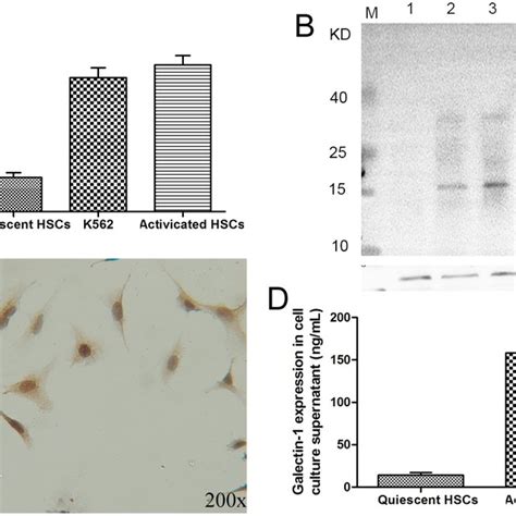 The Expression Of Galectin In Human Hscs Primary Hscs Isolated From