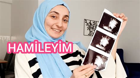 HAMİLEYİM EŞİMİN VE AİLEMİN TEPKİSİ İLK BELİRTİLER İLK KALP ATIŞI