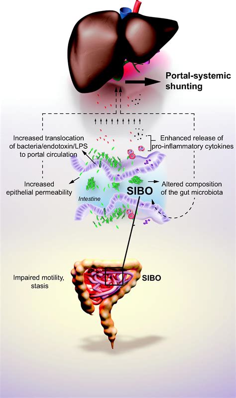 The Gut Microbiota And The Liver Pathophysiological And Clinical Implications Journal Of