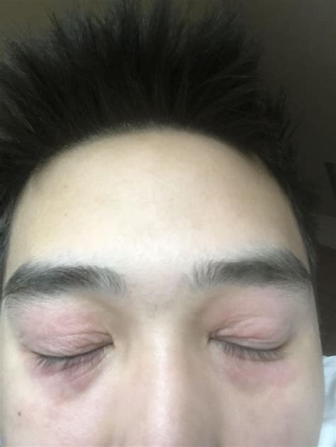 Weird skin condition : r/skin