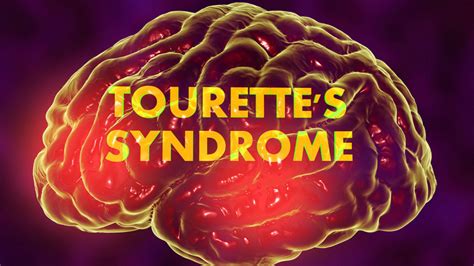 tourette syndrome dispelling  myths  amino company