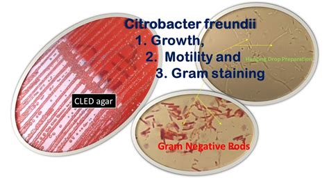 Citrobacter Freundii Growth Motility And Gram Staining Youtube