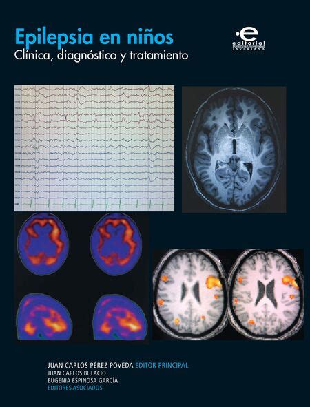 Epilepsia en niños Clínica diagnóstico y tratamiento comprar en